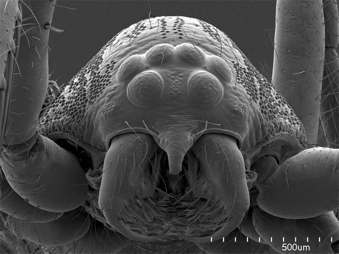 عنکبوت در زیر میکروسکوپ الکترونی
